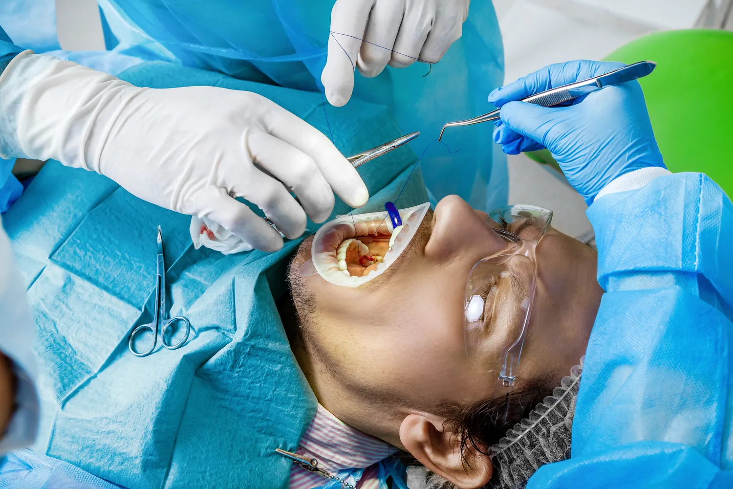 Implanty stomatologiczne Lublin