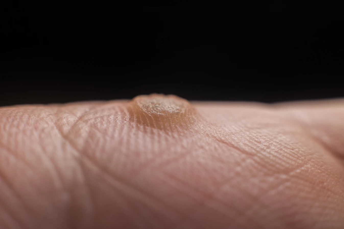 Pedicure leczniczy Szczecin