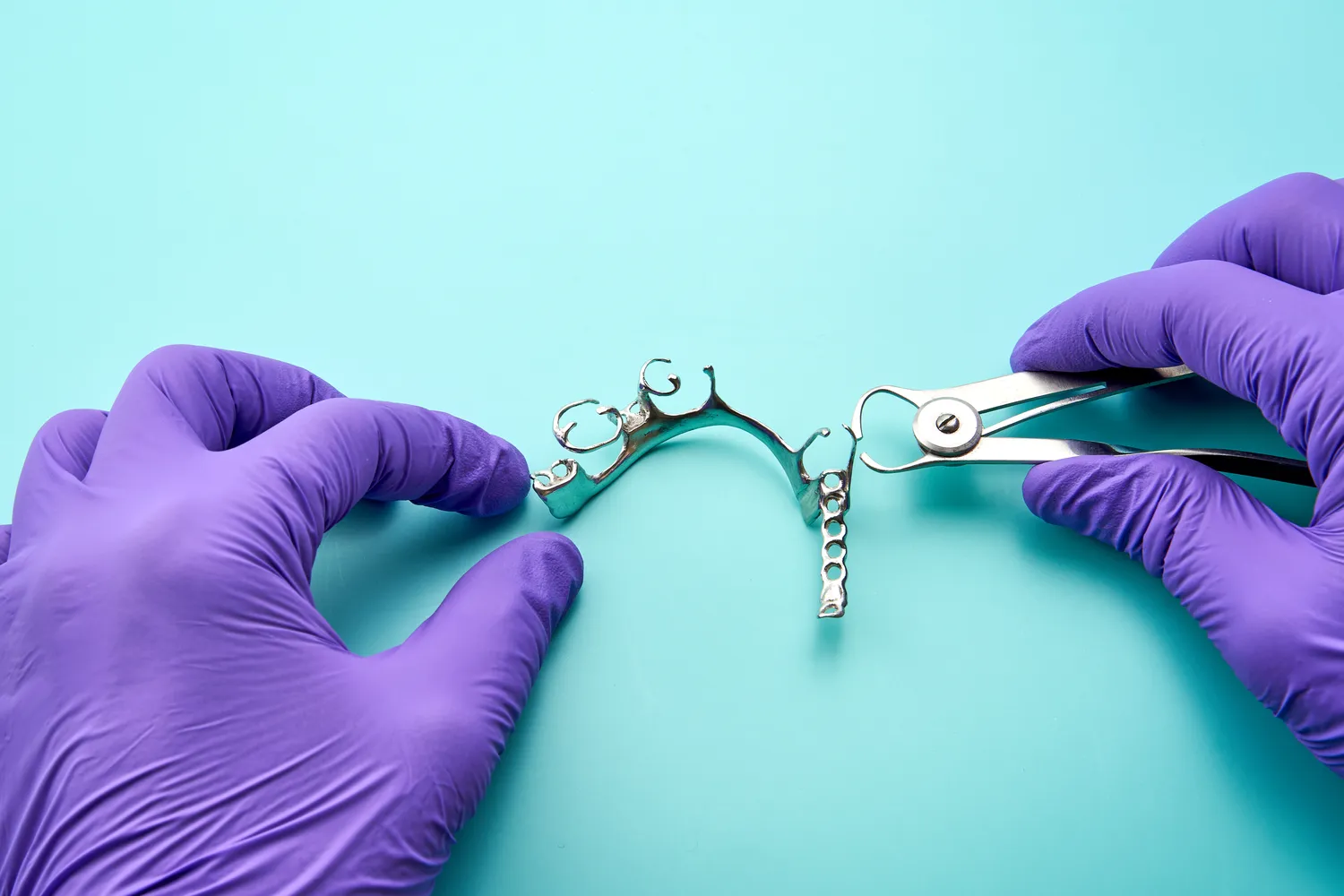 Ile czasu trwa leczenie kanałowe?